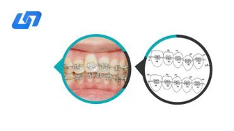 Ortodontisk Niti Reverse Curve Arch Wire